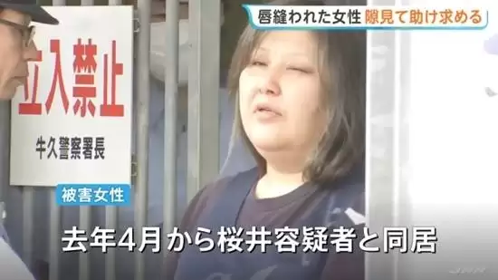日本49岁女子用针把室友嘴缝上 受害者用纸条求救