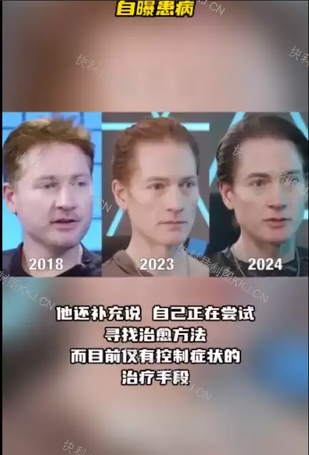 美国换血富豪回应克隆自己：没创造胚胎 只是将实际细胞年龄归为零岁